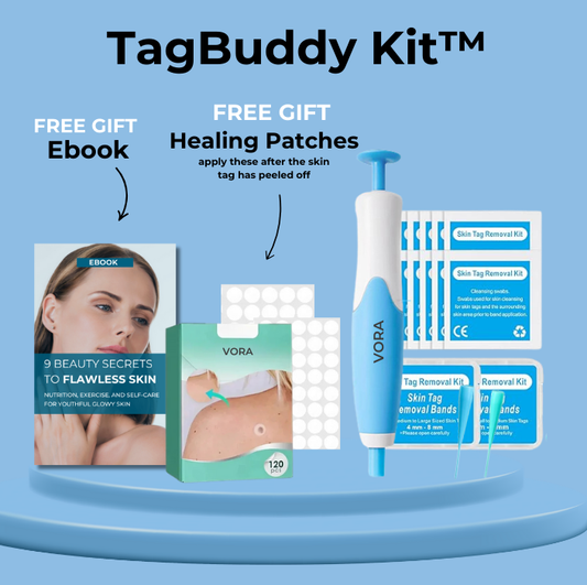 The TagBuddy Kit™ - No More Skin Tags